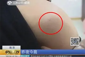 服装店内有蜜蜂 女子试衣服被蛰起纠纷图片