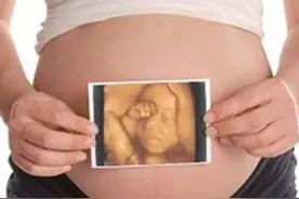 准妈妈看过来:新疆明确胎儿四维彩超最高收费300元图片