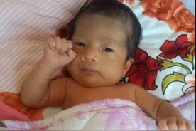 宝宝连续5天未大便，小脸蜡黄，妈妈快急死了！图片