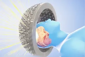 3D动画演示脑肿瘤放疗的伽玛刀原理，看的我头疼视频封面