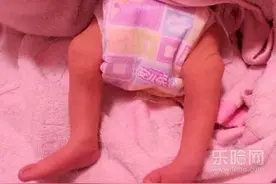宝宝绑腿能矫正箩筐腿吗图片