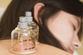 拔火罐需注意 做好保暖不喝酒图片