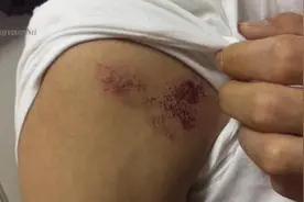 纽约华裔男子KTV唱歌频换房 遭多名服务员暴打图片