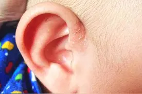 专家在线丨原来宝宝抓耳朵，是在暗示有这些问题啊！图片