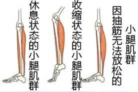 抽筋儿=缺钙？聊聊抽筋儿那些事儿图片