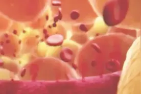 血管破裂是如何愈合的3d动画完美演示视频封面