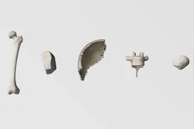3D动画演示骨骼系统，女人有多少块骨头组成呢？