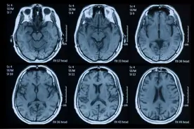 家暴中难以察觉的脑损伤图片