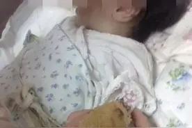 婆婆用缝衣针给宝宝扎“马牙子”，惨致宝宝全身脓肿图片