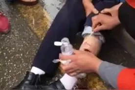 威宁闹市蹿出恶狗，逢人就咬伤8人，最终民警乱棍“击毙”图片