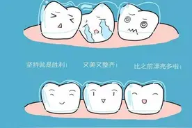 爱牙课堂︱在国内做隐形矫正 出国后如何衔接？图片