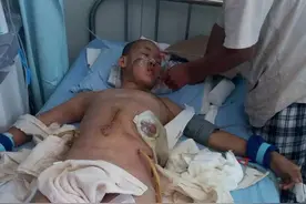 哈尔滨14岁男孩玩鞭炮，崩碎铁罐扎破肠子丨妈妈也受伤，他跑出1000多米喊救命……图片