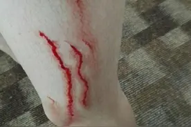 酒店浴室玻璃自爆，女孩浑身是血，快检查一下你家玻璃会不会炸？图片