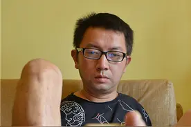 成都36岁“断臂哥”的励志人生图片