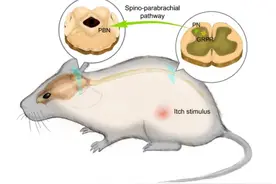 挠痒痒停不下来？中国科学家率先发现其第一条神经通路图片