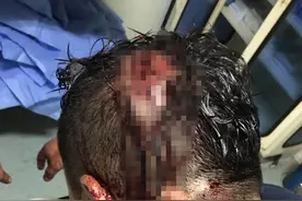 海淀四季青医院保安与患者冲突致1人头部被打伤 警方介入调查图片