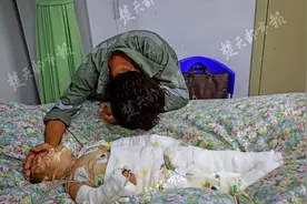 8岁姐姐给弟弟洗澡忘放冷水，1岁半男童全身66%皮肤被严重烫伤图片