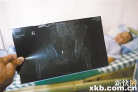 平板拖车与电动车相撞 致五旬男子大腿骨折图片