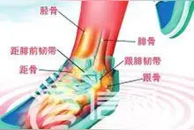 “崴脚”知识知多少 专家提醒：受伤后需制动冷敷图片