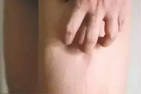 从腿看血栓风险！腿上有血栓，到底能不能动，请遵循2个原则图片