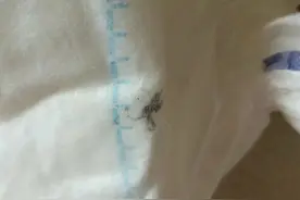 “露安适”纸尿裤疑现黑色虫形异物，商家先称是蚊子后称是粘合剂图片