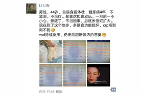 撕了点脚上的死皮，他居然多器官损坏图片