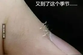 天气干燥，你的手指长“倒刺”了吗？图片