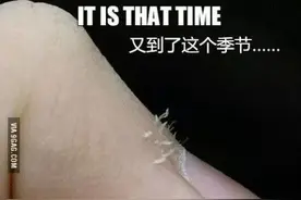 天气干燥，你的手指长“倒刺”了吗？图片