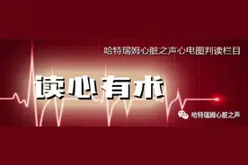 「读心有术」222期：尖端扭转型室速的前因后果，一文搞定！图片