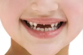 孩子几岁换牙最正常，孩子换牙时出现这种情况要就医检查