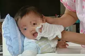 孩子身上长出黑痣妈妈居然这样做，最终却导致孩子失去了生命图片