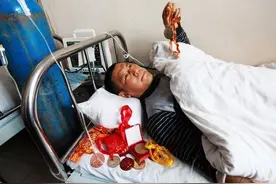 他是摔跤冠军，比赛致残退役被迫当保镖，患癌症领导不管没钱等死图片