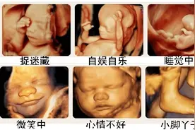胎儿的微笑！四维超声检查你不知道就OUT了图片