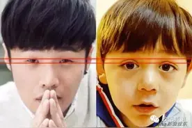 宁乡女子整容割成“三眼皮”，出门只能带墨镜！图片