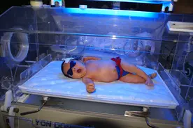 新生儿黄疸，妈妈别着急，分辨黄疸我有诀窍哦图片