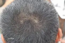 发旋的方向与数量的猜想图片