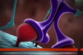 实拍：艾滋病浸入人体的整个过程，太可怕了！