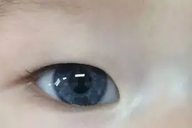 蓝眼睛的秘密 爱耳日专题图片