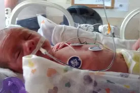 27周早产儿宝宝完全依靠设备维持生命，干瘪的样子惹人心疼！视频封面