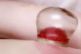 拔火罐后能洗澡吗 拔火罐后的注意事项图片
