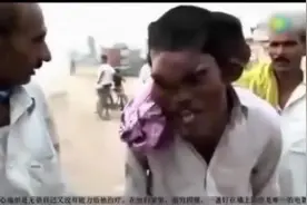 印度南部一男子畸形，竟然还堂姐近亲结婚，生下孩子没人敢看！视频封面