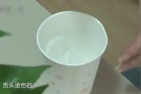 舌头烫伤如何急救 生活窍门