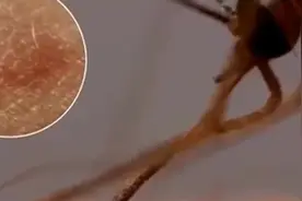 10万倍显微镜下，蚊子是这样吸血咬人的视频封面