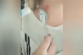 教大家快速去草莓印的小妙招，情侣必备哦视频封面