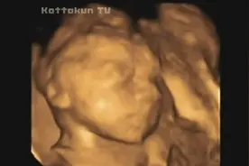 去医院做四维彩超啥都不让看？我们来带你全方位了解四维彩超！视频封面