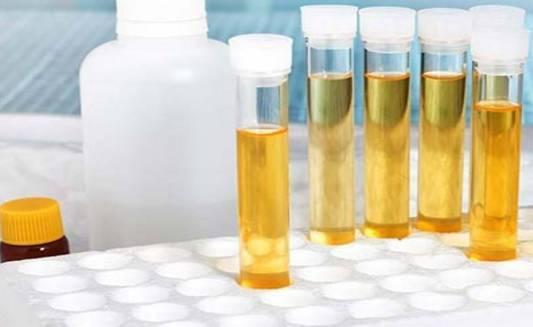 从尿液看你的健康状况，你中招了吗？