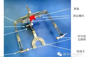 阿曼吉尔巴赫‖面弓数据转移牙合架‖个性切导盘‖Artex咬合架原理汇总图片