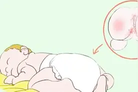 58到家：婴儿红臀预防与护理-视频教程视频封面