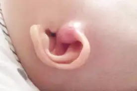 判断宝宝生病只需要看这三个部位，学会后宝妈你也能变医生！视频封面