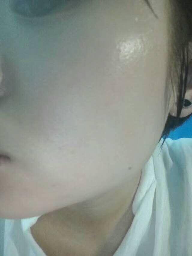 不用激素产品就不会得皮炎？｜你真的会挑选洗面奶吗？